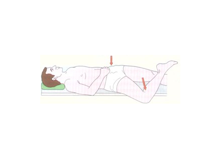 肌筋膜炎的症状