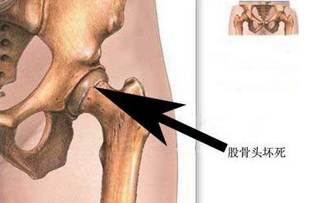 男科分期症状