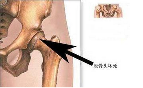 治疗男科的方法